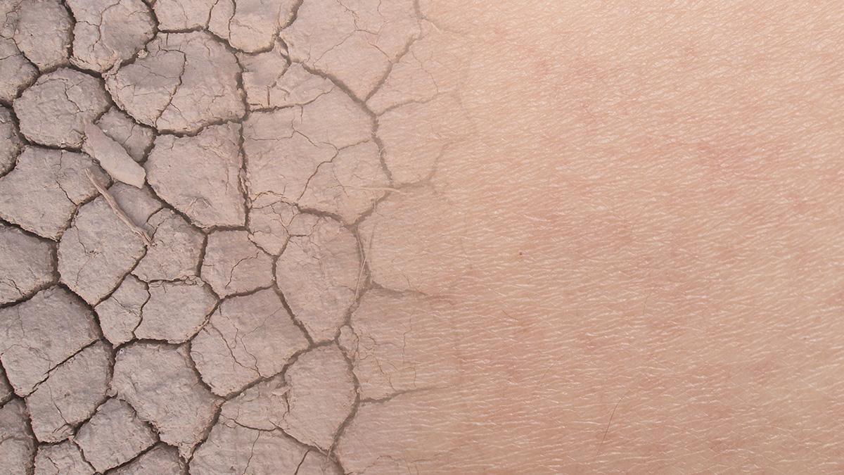 Cracked desert soil transmutes into a skin texture